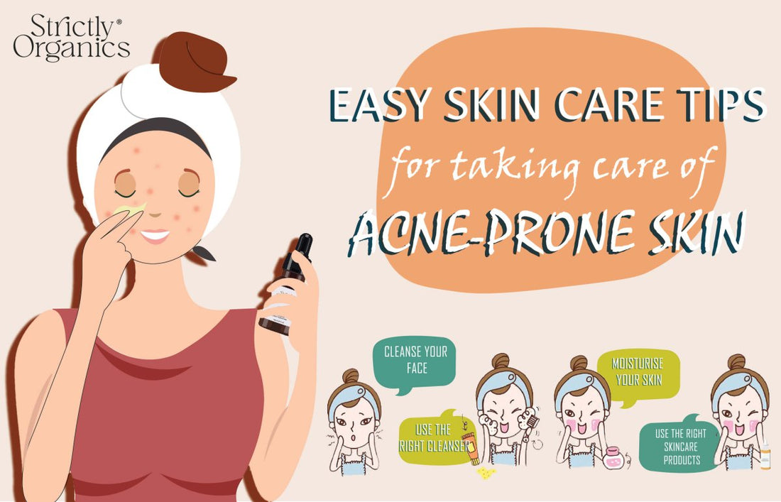 Easy Skin Care Tips for Taking Care of Acne-Prone Skin STRICTLY ORGANICS