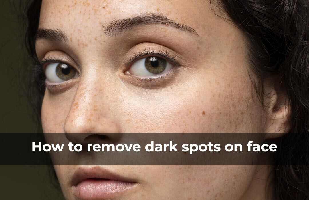How to Remove Dark Spots on Face - STRICTLY ORGANICS
