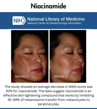 Niacinamide Clinically Proven Result Study - NIH