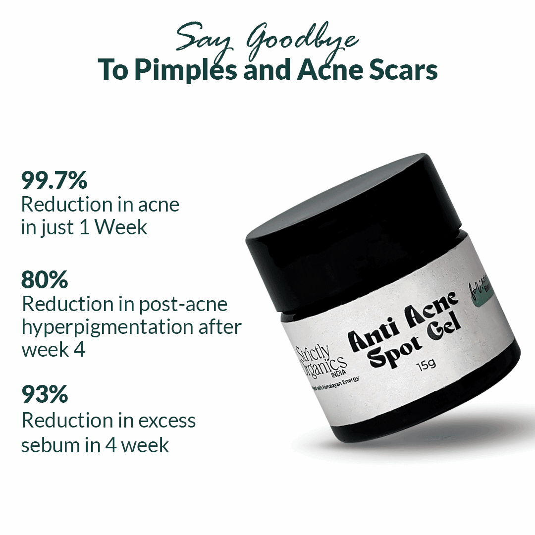 https://strictlyorganics.co/cdn/shop/products/anti-acne-duo-anti-acne-face-wash-anti-acne-spot-gel-262438.png?v=1700632406